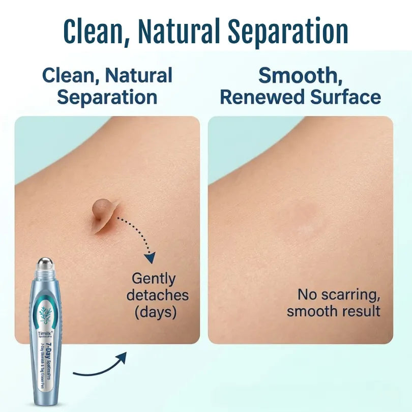 💧Timilk® SpotlessPro Advanced Skin Care Pen