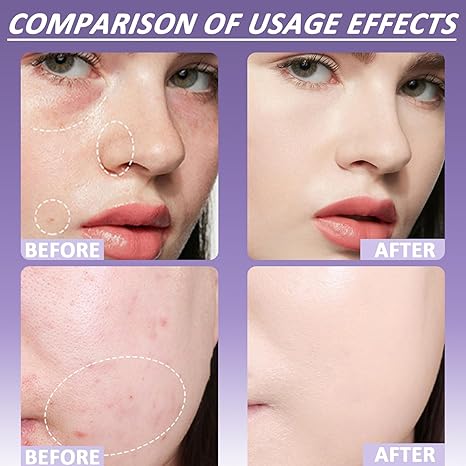 🔥 Pirkite vieną, gaukite antrą nemokamai! 🎁 Švelnus, matinis kreminis maskuoklis-LT