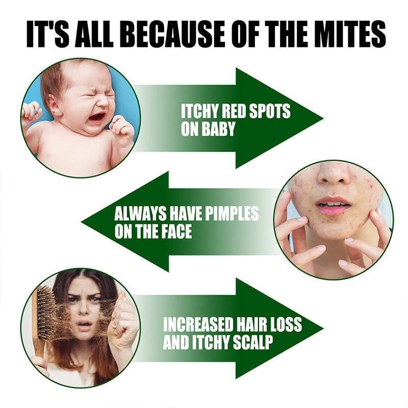 ⚡Ribotas išpardavimas Pirkite 2, gaukite 1 nemokamai⚡-🧑‍⚕️Stiprus dulkių erkučių šalinimo purškiklis-LT