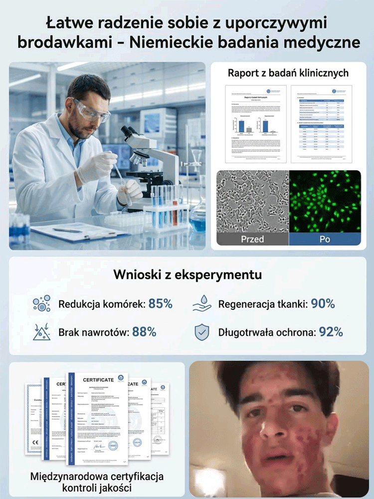 Wałek do pielęgnacji skóry do usuwania brodawek