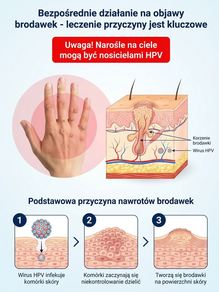 Wałek do pielęgnacji skóry do usuwania brodawek