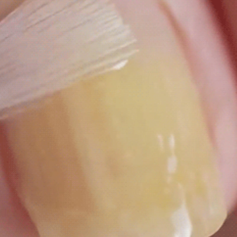 Švelnus ir efektyvus natūralių nagų atkūrimo sprendimas-LT