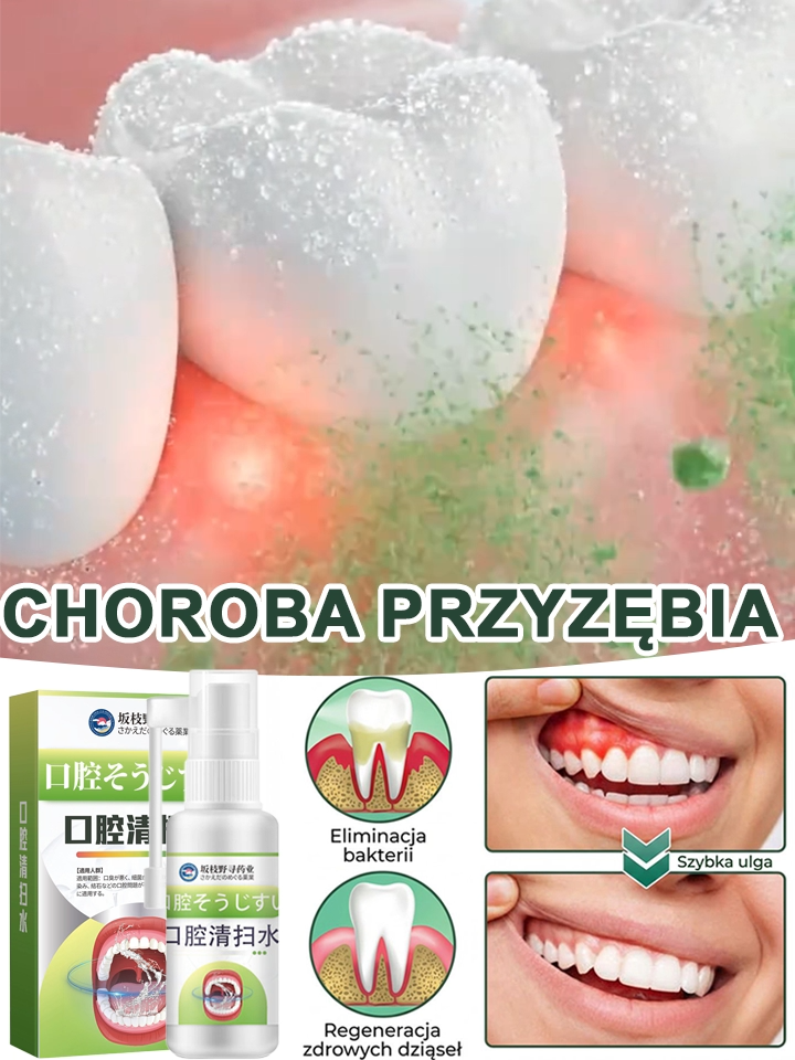 [Wyprodukowano przez Instytut Nobla, Niemcy] Spray rozpuszczający kamień nazębny